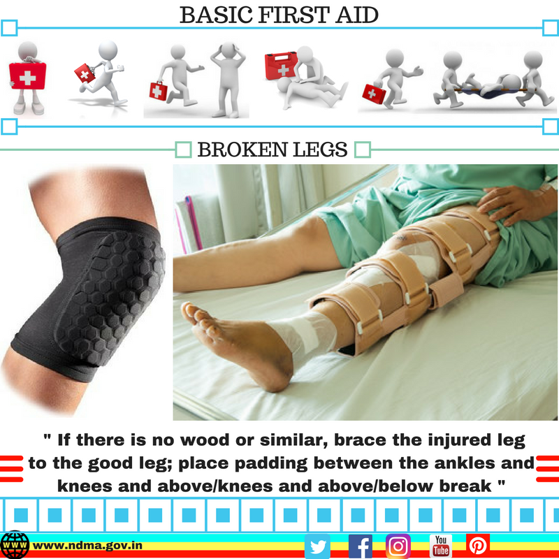 Brace the injured leg to the good leg; place padding between the ankles and knees
